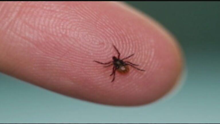 Health Leaders Warn Of Tick Bites